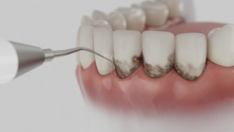 Trusted Tooth Extraction service in Abilene, KS - Dentist Open Now